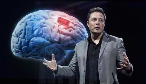 马斯克的脑机接口:颠覆人类与技术的交互方式